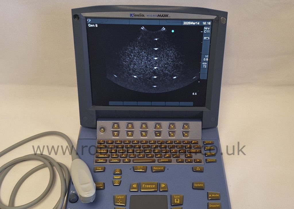Micromaxx Sonosite MicroMaxx Ultrasound System + C11e 8-5 MHz P07161-16 ...