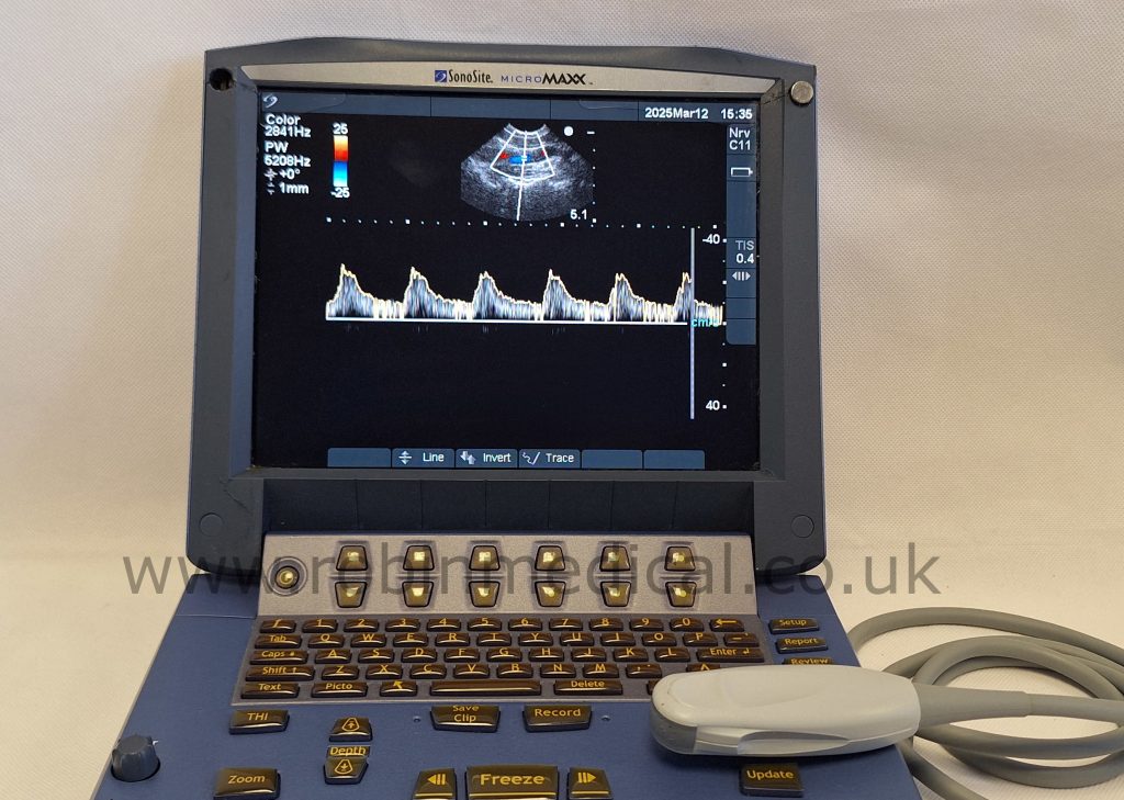 Micromaxx Sonosite MicroMaxx Ultrasound System + C11e 8-5 MHz P07161-16 ...