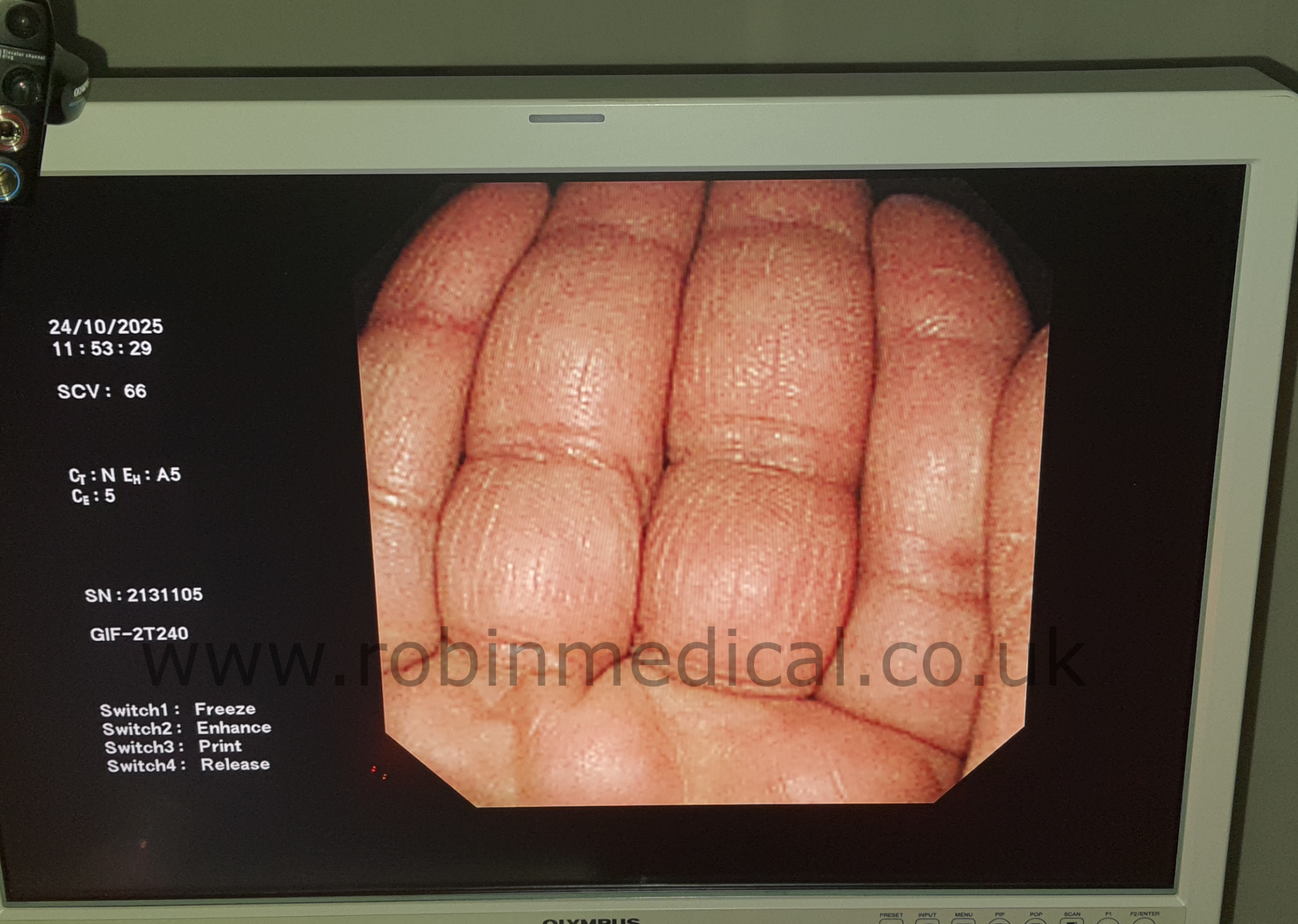 Image Quality Test Alternative