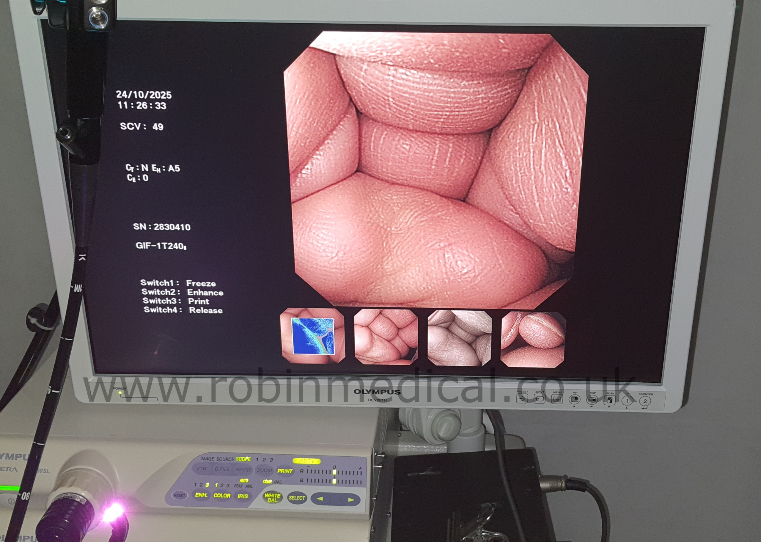 Image Quality and Scope Head Illumination