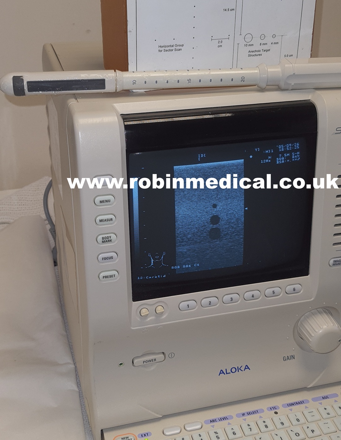 Aloka UST-672 TR probe - Image 8
